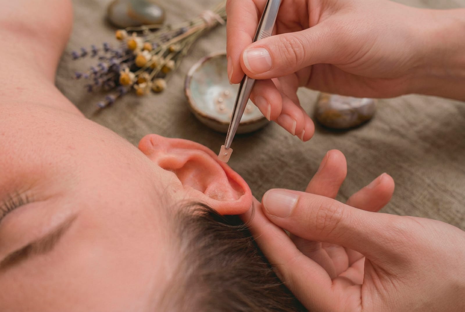 Terapeuta colocando un balín de auriculoterapia en un punto de acupresión de la oreja para aliviar el estrés y equilibrar el sistema nervioso.